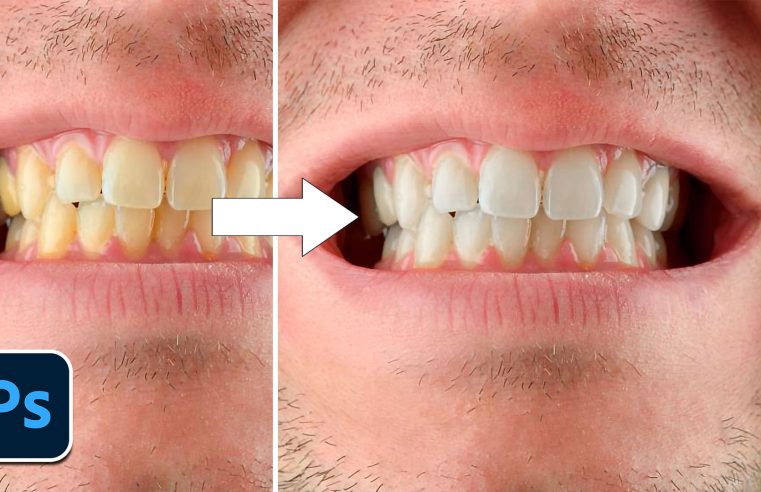 Sbiancare i denti con Photoshop in 3 minuti